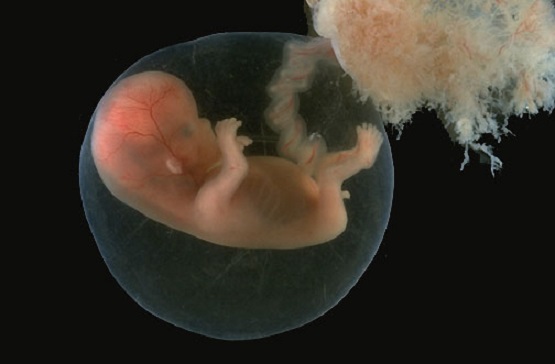 placenta cancer1